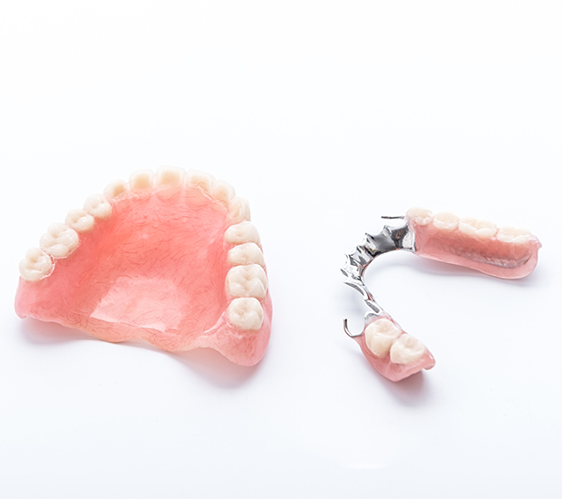 Miami Partial Dentures for Back Teeth
