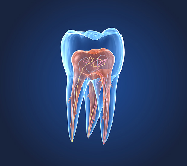 Miami What is an Endodontist